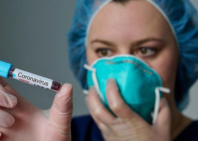 Rusiyada daha 2 min 186 nəfər koronavirusa yoluxub