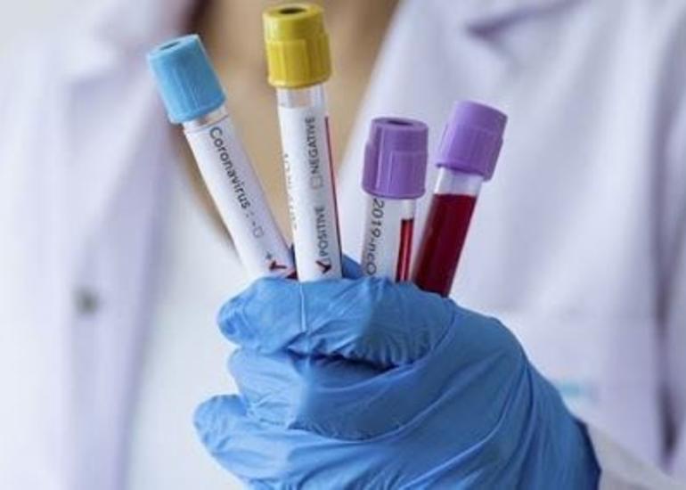 Sosial şəbəkədə koronavirus vaksini satan şəxs saxlanıldı