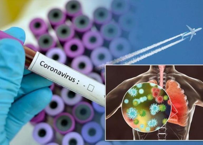 TƏBİB: Xaricdən gələnlər arasında koronavirusa yoluxma 20 faizdən çoxdur
