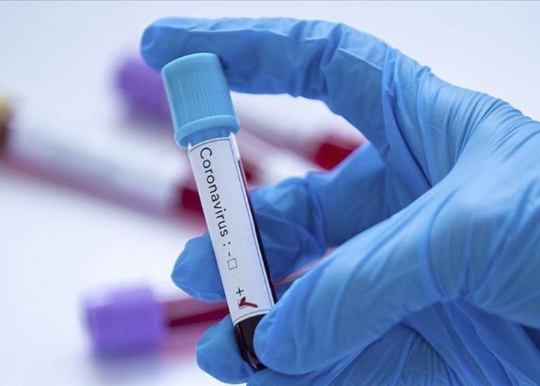 Rusiyada 3 400 nəfərə yaxın koronavirusa yoluxma qeydə alındı
