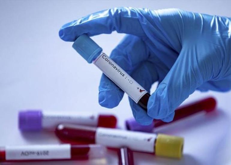 İranda ötən sutkada 167 nəfər koronavirusdan ölüb