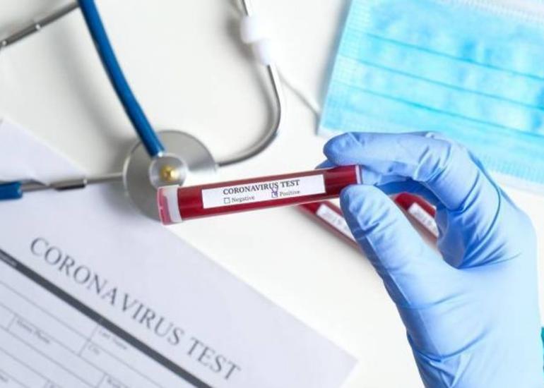 İspaniyada son sutkada koronavirusdan 331 nəfər ölüb