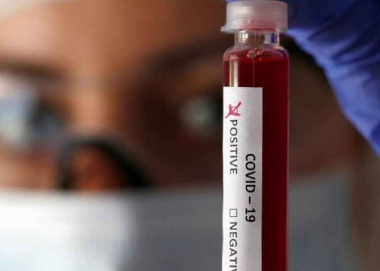 İspaniyada son sutkada koronavirusdan 301 nəfər vəfat edib
