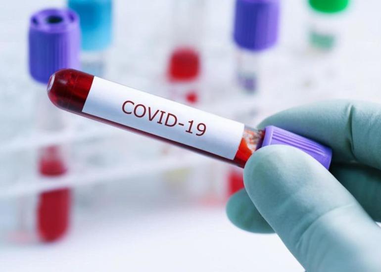 Azərbaycanda indiyədək 138000 nəfər koronavirus infeksiyasına yoluxub