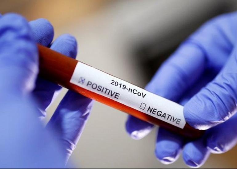 ABŞ-da koronavirusdan ölənlərin sayı 83 mini ötüb
