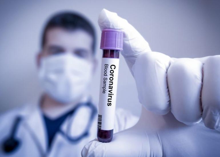 Baş Nazirin müavini: “Azərbaycanda koronavirus qurbanlarının sayı dünya göstəricisindən 5 dəfədən azdır”