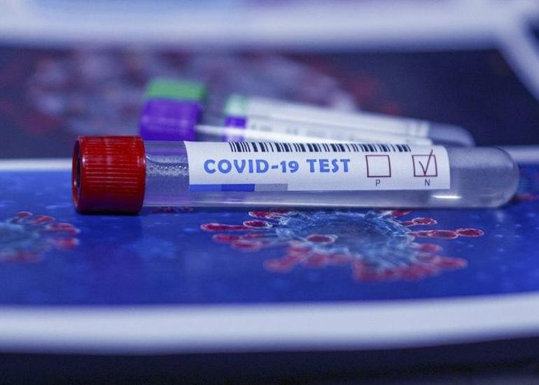 Rusiyada COVID-19-dan 489 tibb işçisi ölüb