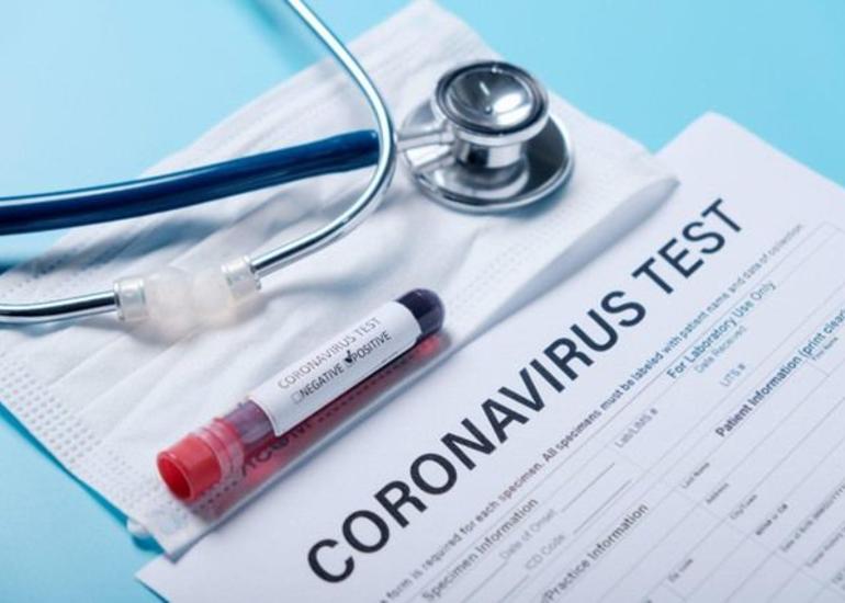Kimlər COVİD-19 risk qrupuna daxildir? - TƏBİB AÇIQLADI