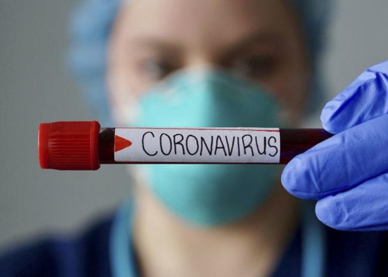 Ermənistanda son sutkada 415 nəfər COVID-19-a yoluxub, 10 nəfər ölüb