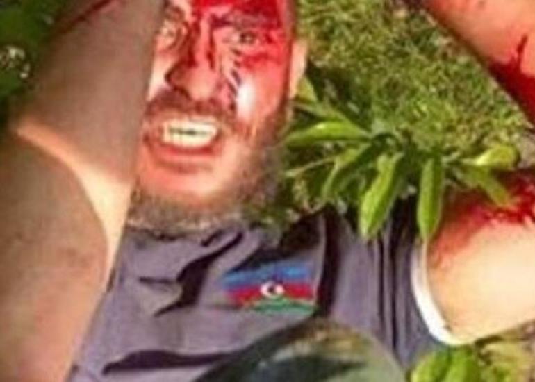 Səfirlərimiz soydaşlarımızı niyə ermənilərin “ağzına” atdı?