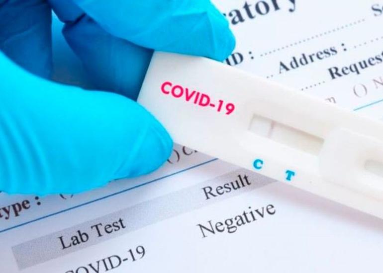 Operativ Qərargah koronavirus testlərinin qiymətinin optimallaşdırılması üçün tədbirlər görməlidir