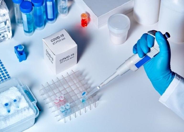 Ölkə üzrə COVID-19-a yoluxma statistikası açıqlanıb