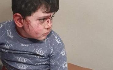 Prokurorluq: Düşmənin cəbhə zonasından kənarda yerləşən Gəncə şəhərini raket atəşinə tutması nəticəsində 5 nəfər həlak olub