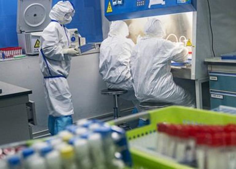 Rusiyada bir gündə koronavirusdan 500-ə yaxın ölüm qeydə alınıb