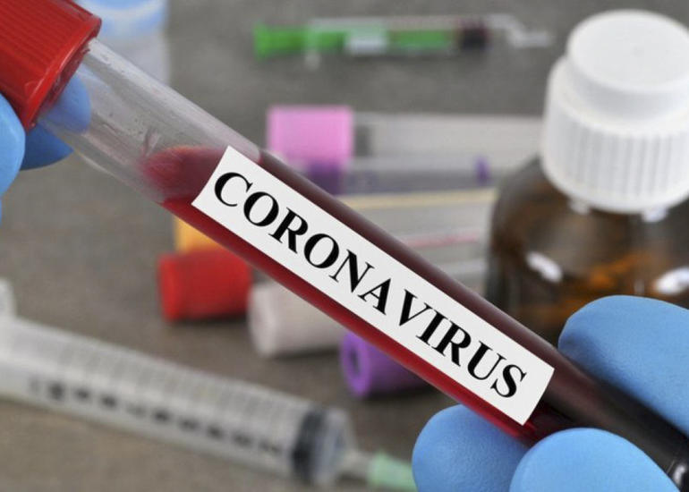 Rusiyada koronavirusdan ölənlərin sayı 122 mini ötüb