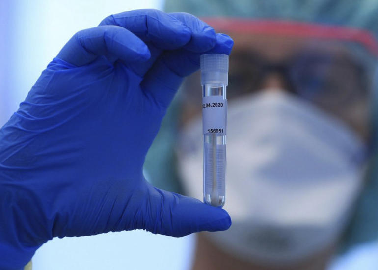 Rusiyada son sutkada koronavirusdan 787 nəfər ölüb