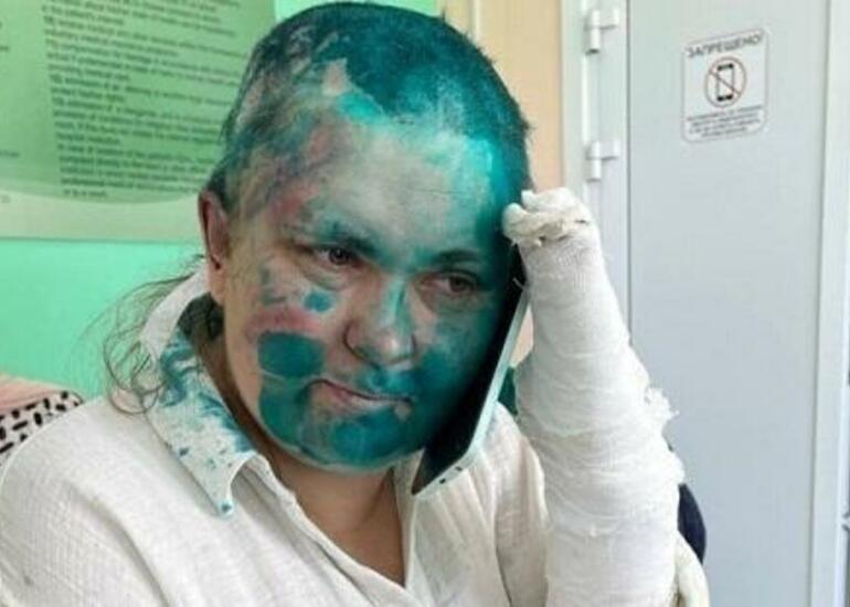 Jurnalistə hücumla bağlı Putinə məruzə edildi