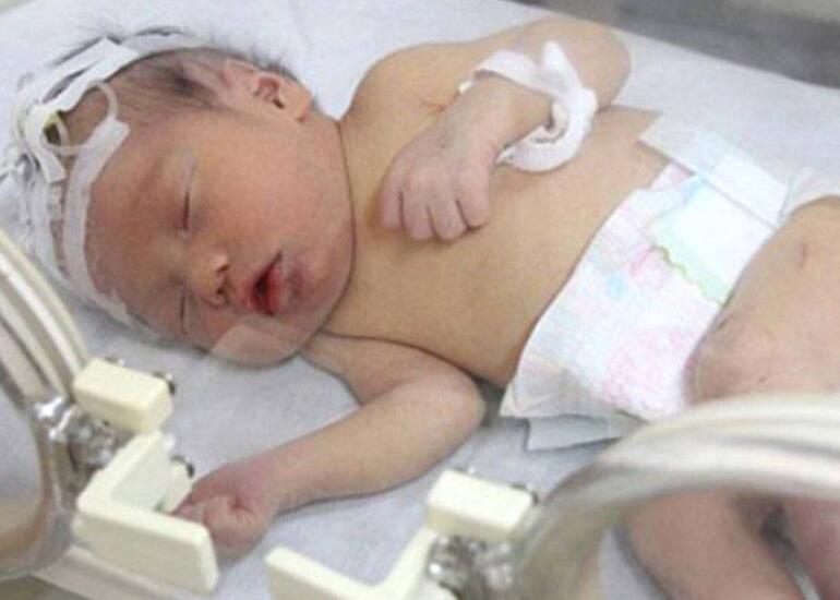 Körpəyə cahil müdaxilə onurğa beyninin qırılması ilə nəticələnib